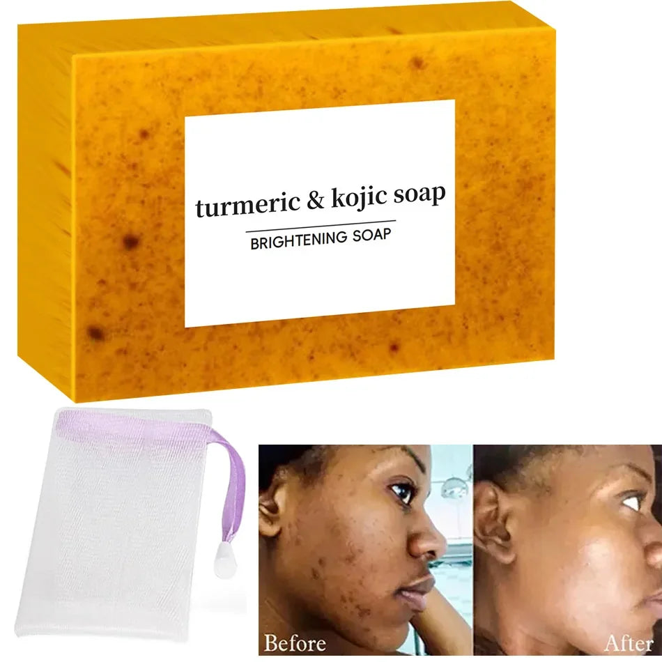 Turmeric Kojic Acid Soap