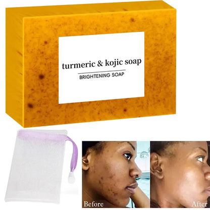 Turmeric Kojic Acid Soap